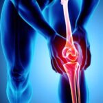 Resistance Band Knee Strengthening Exercises